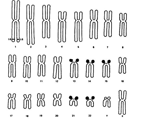 Схема хромосомного набора. 46 Хромосом у человека. Хромосомный набор человека. Набор человеческих хромосом. Генетический набор хромосом человека.